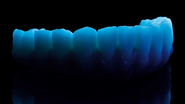 Digital Wax-Up 케이스 04